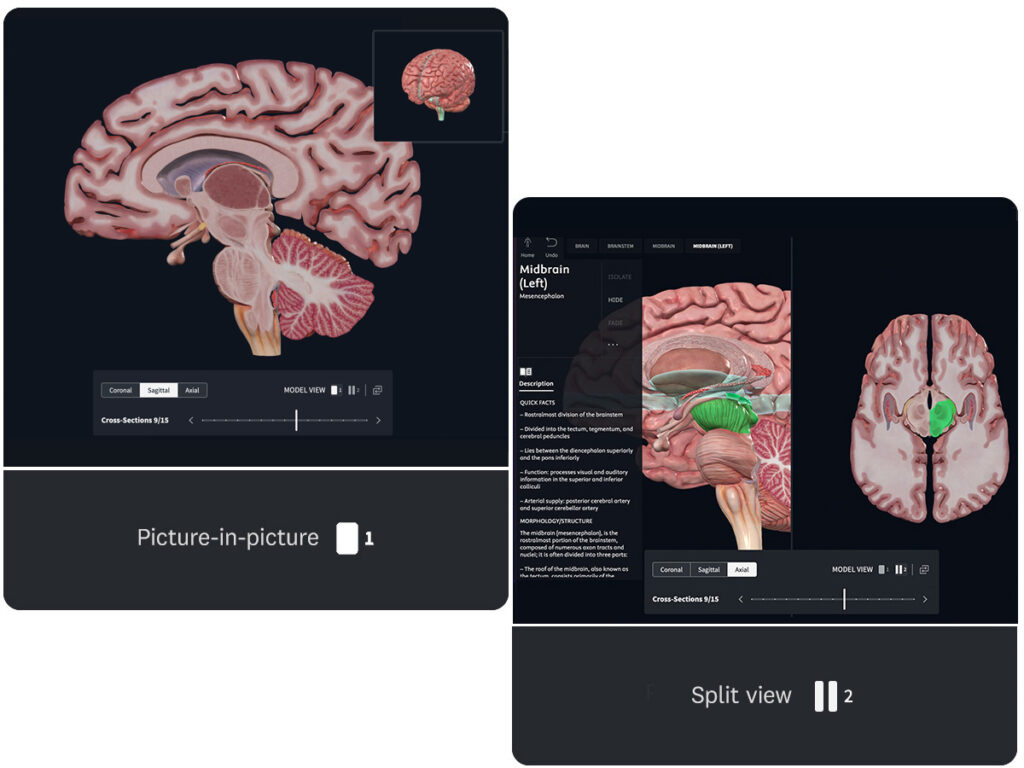Comparison of two cross-section viewing modes for brain beta: picture-in-picture mode showing 3D brain model with small reference view and coronal, sagittal, and axial plane options; split view mode displaying full-screen 3D model alongside detailed anatomical cross-section with complete information panel
