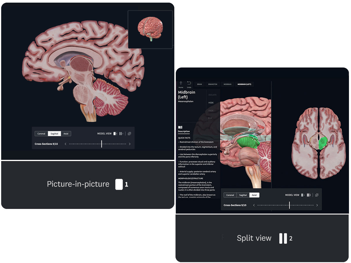 Comparison of two cross-section viewing modes for brain beta: picture-in-picture mode showing 3D brain model with small reference view and coronal, sagittal, and axial plane options; split view mode displaying full-screen 3D model alongside detailed anatomical cross-section with complete information panel 